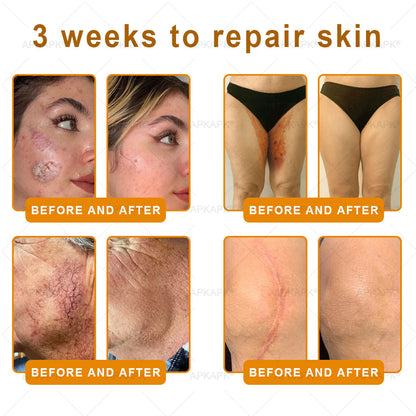 APKAPK®--Only 10 jars! Grab an exclusive 30% discount now! Keep your skin youthful and glowing in just 1 to 3 weeks. Don’t miss your chance—this offer won’t come around again until next year. Act fast! 180-day money back guarantee!